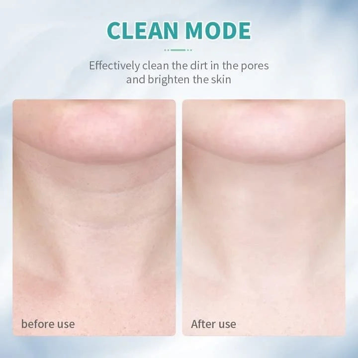 3 In 1 Electric Face Massager Anti Wrinkles Facial Massager Face Slimming, Sculpting, Uplifting